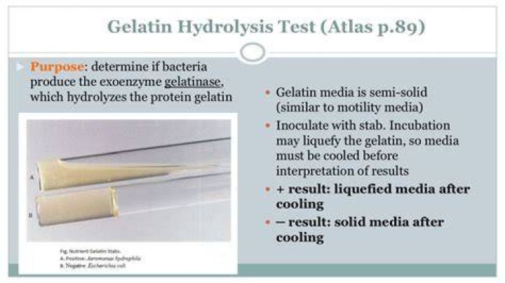 How do you get alcaligenes faecalis?
